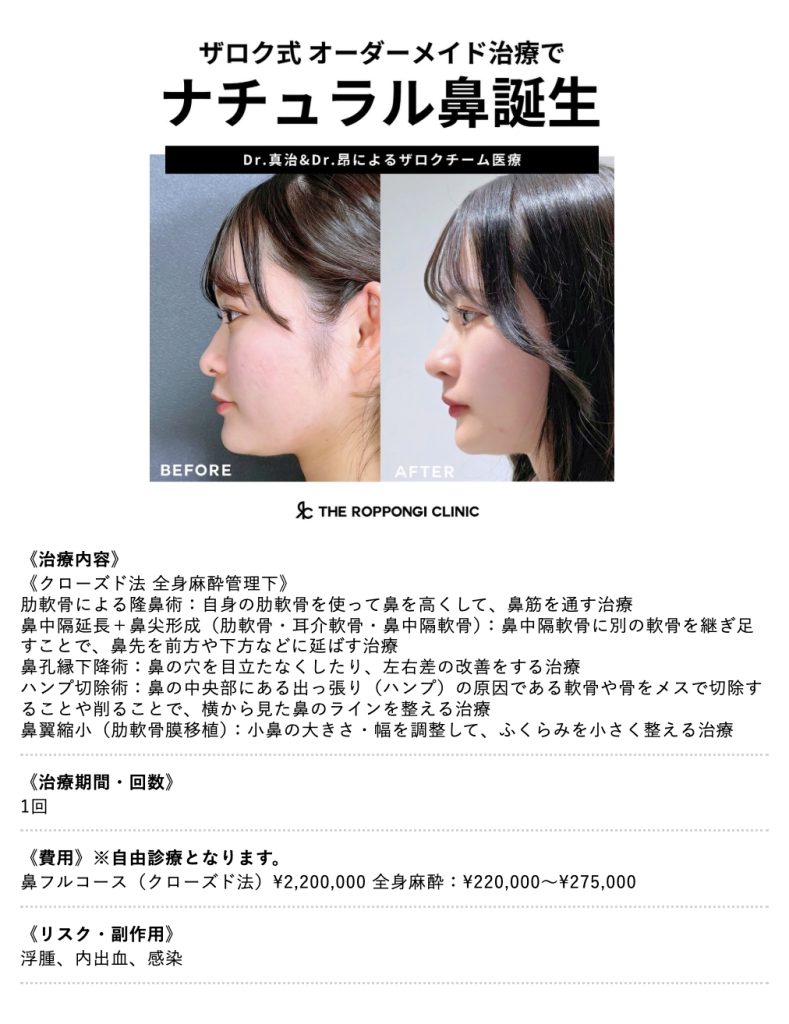 鷲鼻の女優はなぜ美しい？横顔の魅力と2026年最新一覧を徹底解説