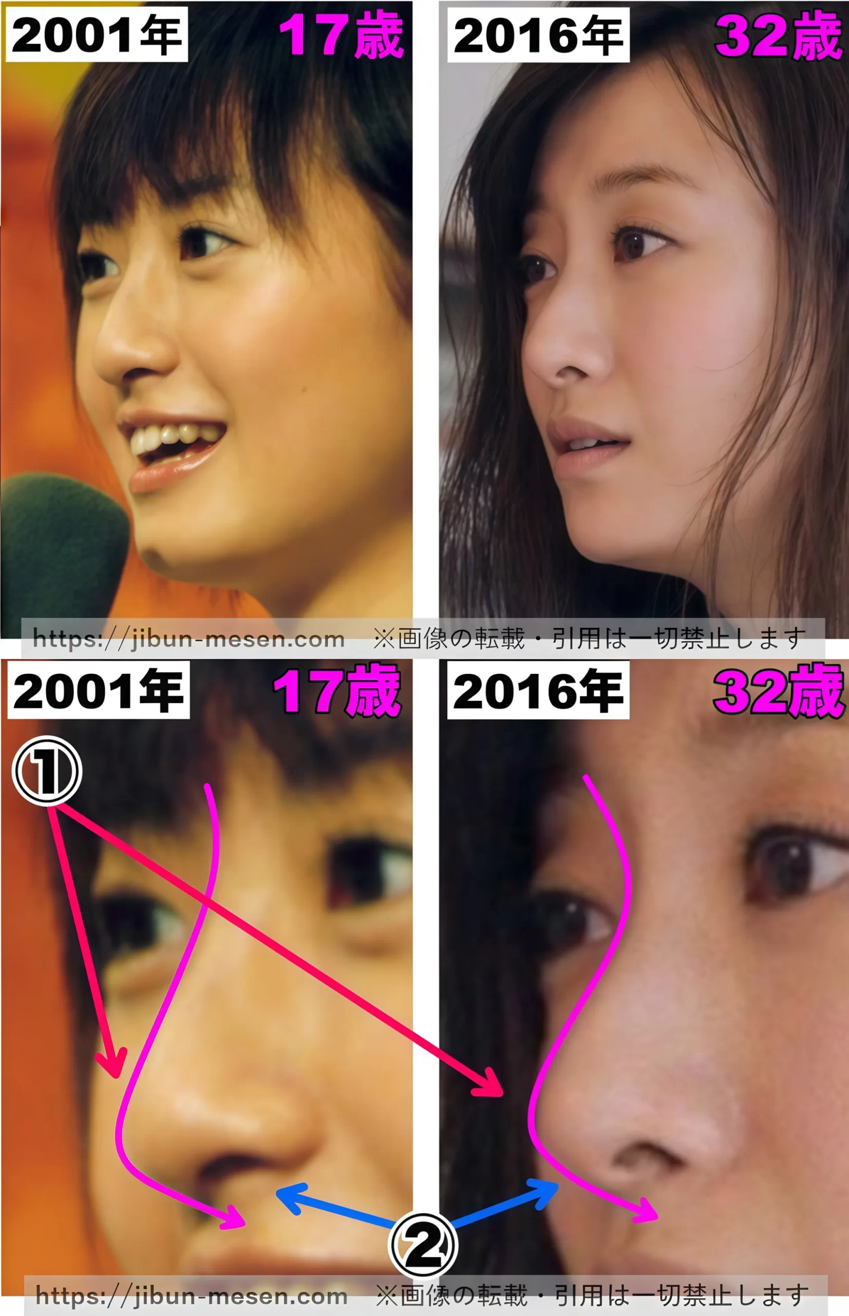 松本まりかの顔立ち変化を検証！整形疑惑と遅咲きブレイクの裏側