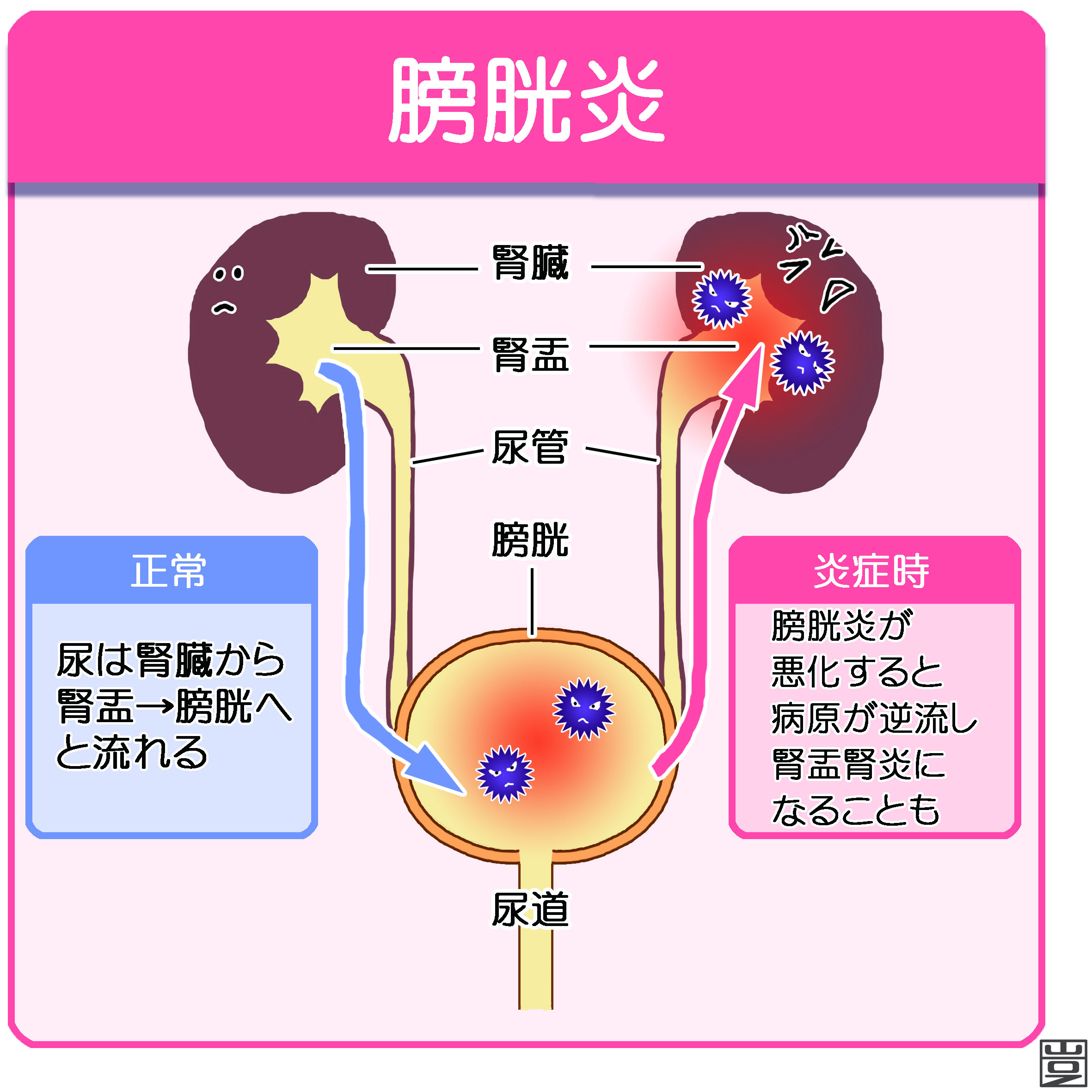 膀胱炎の病院は何科？内科・婦人科・泌尿器科の選び方と内診の真実
