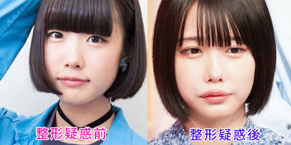 あのちゃんの昔と今を徹底検証！地下アイドル時代の画像から見る「整形疑惑」の真相と唯一無二の美学【2026年最新】