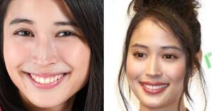 【徹底調査】 広瀬 アリス 顔 変わっ た 衝撃の最新ニュース #970