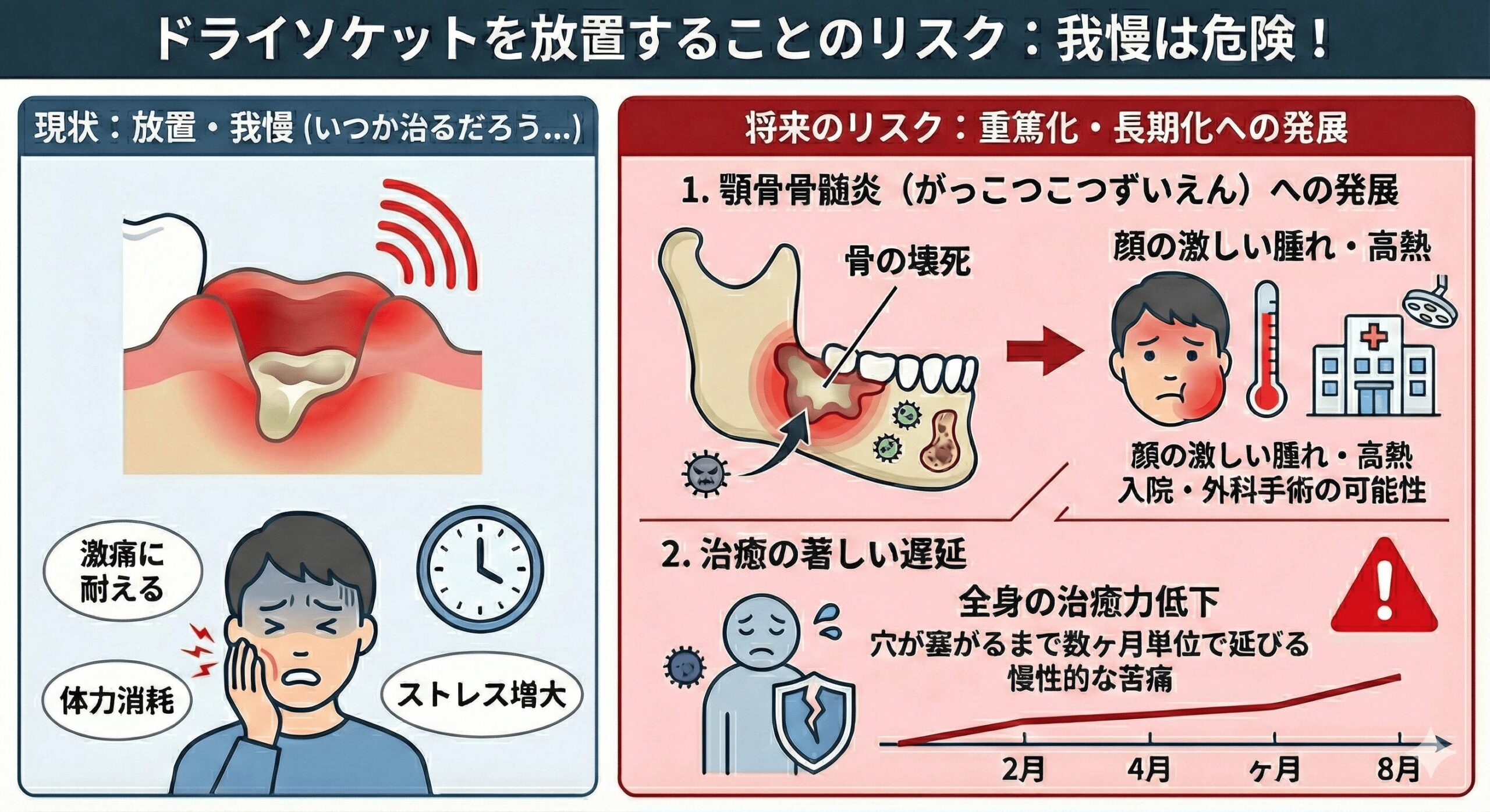 ドライソケットの治し方完全ガイド｜抜歯後の激痛を止める対処法
