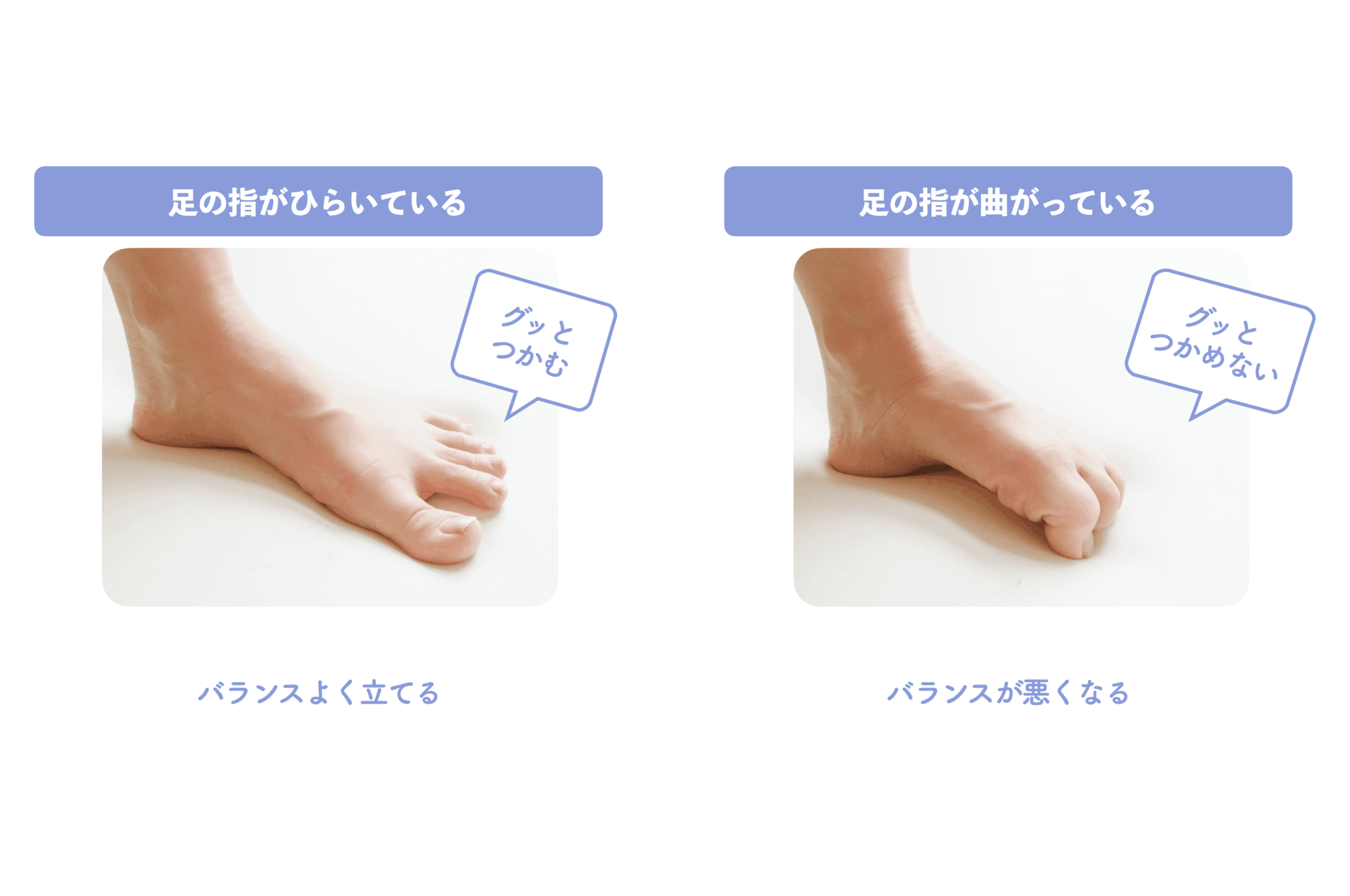 足指を広げる効果の真相！2026年最新の冷え・外反母趾対策と罠