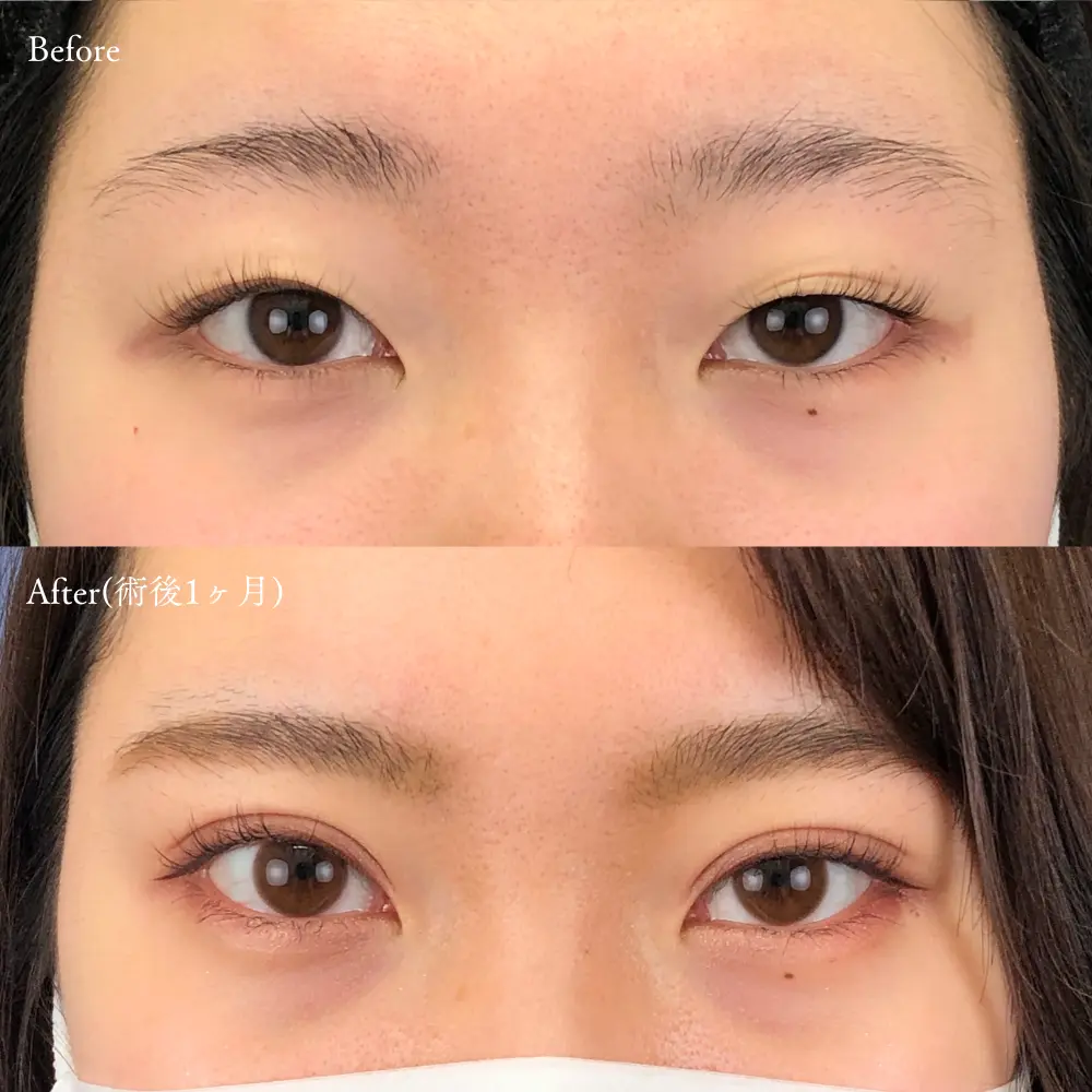 なぜ雌雄眼に惹かれるのか？人相学が明かす性格と天才肌の秘密